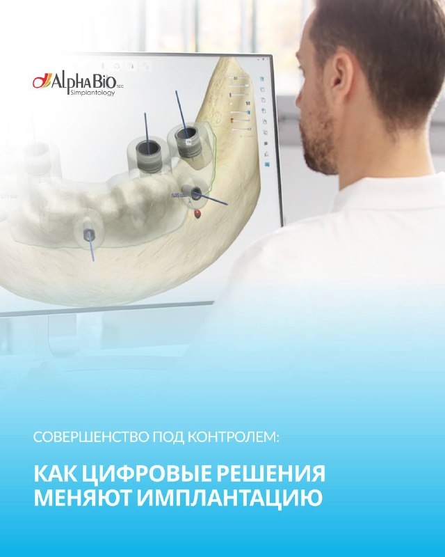 Совершенство под контролем: как цифровые решения меняют имплантацию Медторг