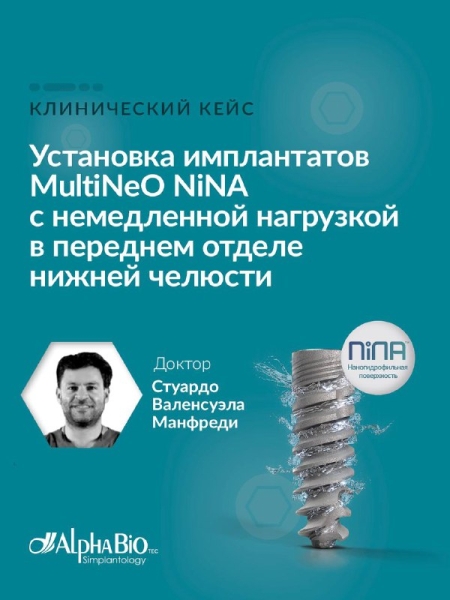 Уважаемые коллеги! Представляем вашему вниманию новый клинический кейс от международного эксперта Alpha-Bio Tec Стуардо Валенсуэла Манфреди (Чили) с установкой имплантатов MultiNeO NiNA и немедленной нагрузкой в переднем отделе нижней челюсти. Медторг